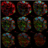 FITC-RAMEB akkumul&aacute;ci&oacute;ja Caco-2 sejtekben.